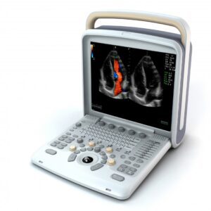 USG Doppler - Q9 - CHISON