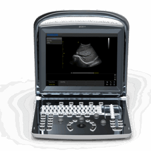 USG B/W - ECO 1 - CHISON