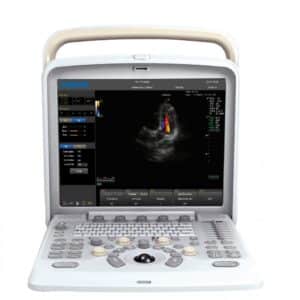 USG Doppler - Q5 - CHISON