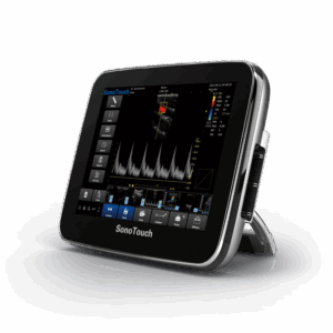 USG Doppler - Sonotouch 20 - CHISON