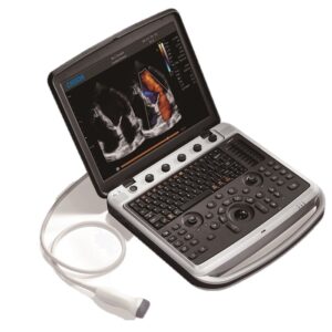 USG Doppler – Sonobook 8 – CHISON